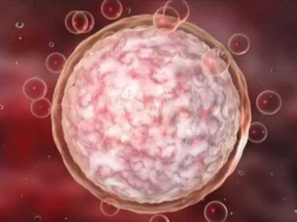 医生建议全部养囊是代表胚胎质量差吗？